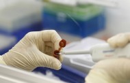Uşak'ta bir kişi H1N1 virüsünden öldü
